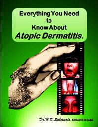 Icon image Everything You Need to Know About Atopic Dermatitis.