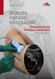 Icon image Blocchi nervosi ecoguidati: Sonoanatomia di base e avanzata