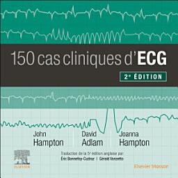 Icon image 150 cas cliniques d'ECG: Édition 2